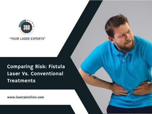 anal fistula surgery