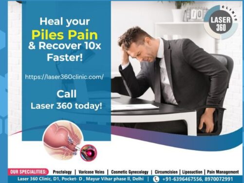 Piles Laser Treatment Cost in Delhi