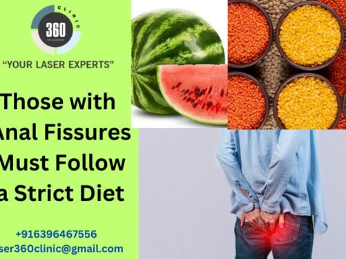 laser treatment for anal fissure