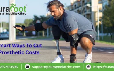 Above Knee Prosthetics