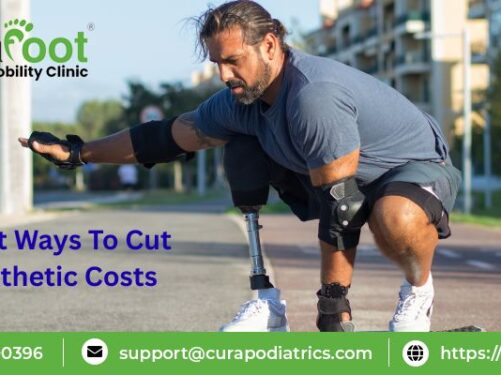 Above Knee Prosthetics