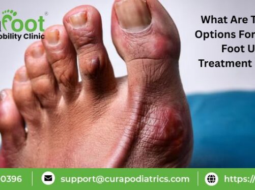 Diabetic Foot Ulcer Treatment in India