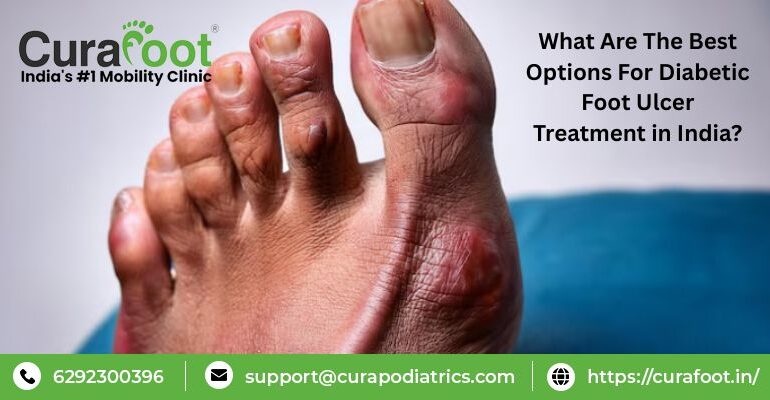 Diabetic Foot Ulcer Treatment in India