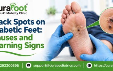 diabetic foot doctor
