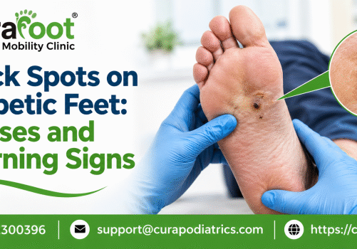 diabetic foot doctor