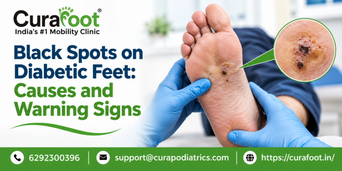diabetic foot doctor